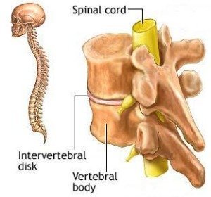 Diagram of a prolapsed spinal disc